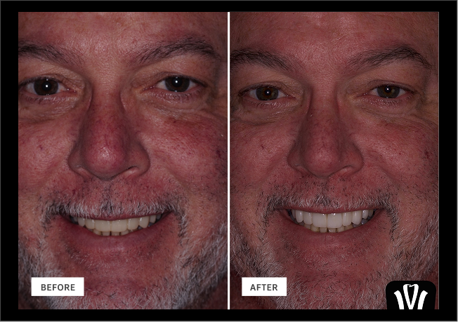Smile Gallery | Woodlands Family Dental